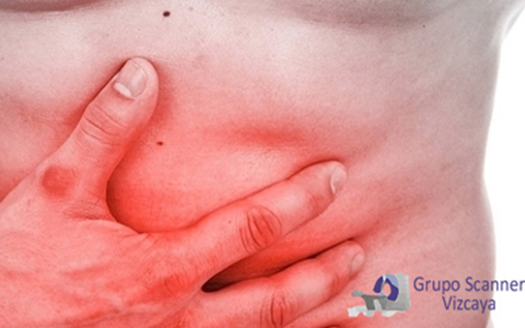 Resonancia Magnetica Abdominal