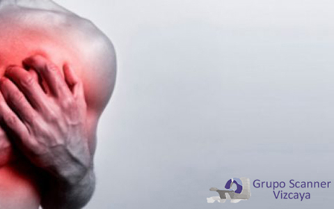 Resonancia Magnetica cardiaca