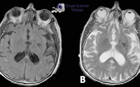 RM con y sin contraste